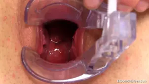 Nurse Ebba is exposed and fucked in a wild p scene